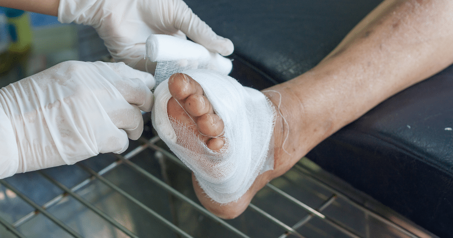 Diabetic Foot care Diabetic Foot care
