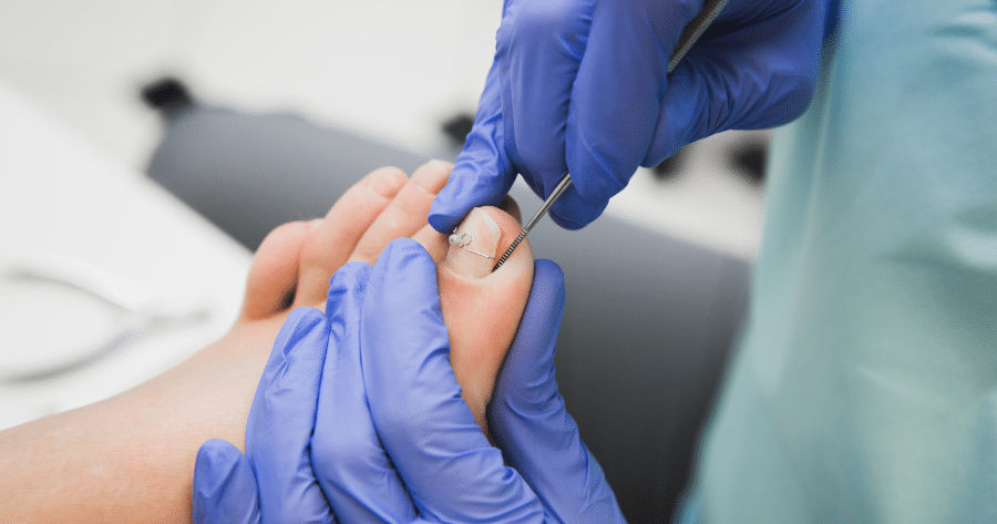 Ingrown Toenail Specialist in Illinois (1) Ingrown Toenail Specialist in Illinois