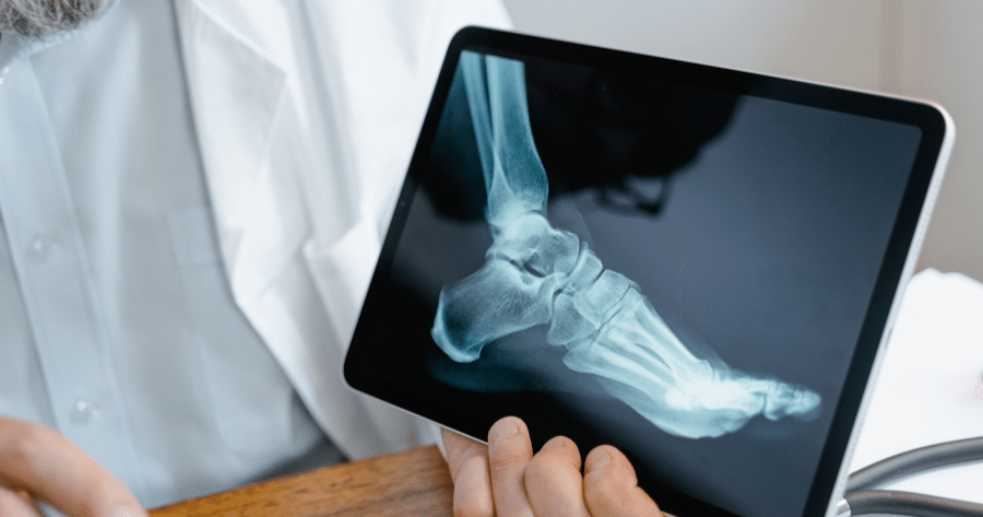 Morton’s Neuroma Specialist in Chicago, IL (2) Morton’s Neuroma Specialist in Chicago, IL