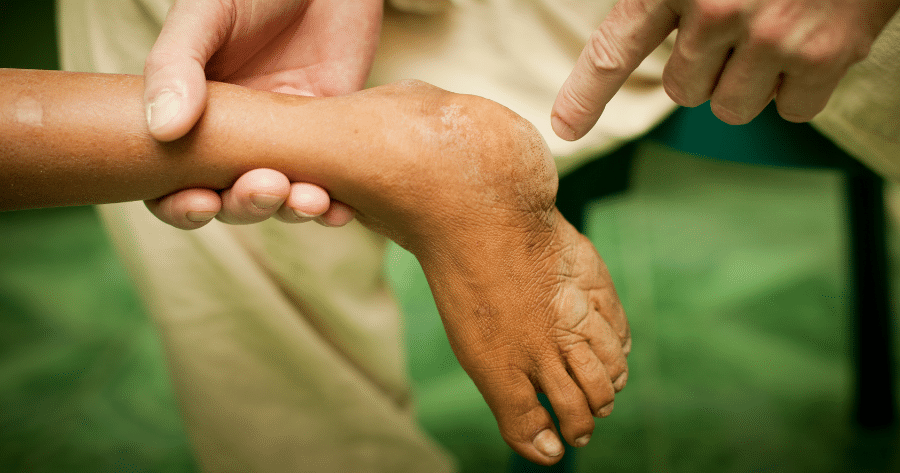 Pediatric Foot deformities Pediatric Foot Deformity Specialist in Illinois